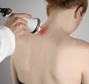 La terapia laser aiuterà ad alleviare l'infiammazione e ad attivare la rigenerazione dei tessuti nel collo