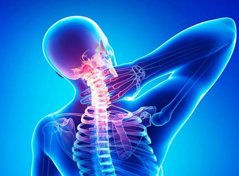 Osteocondrosi della colonna cervicale