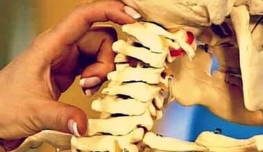 Le ragioni dello sviluppo dell'osteocondosi cervicale