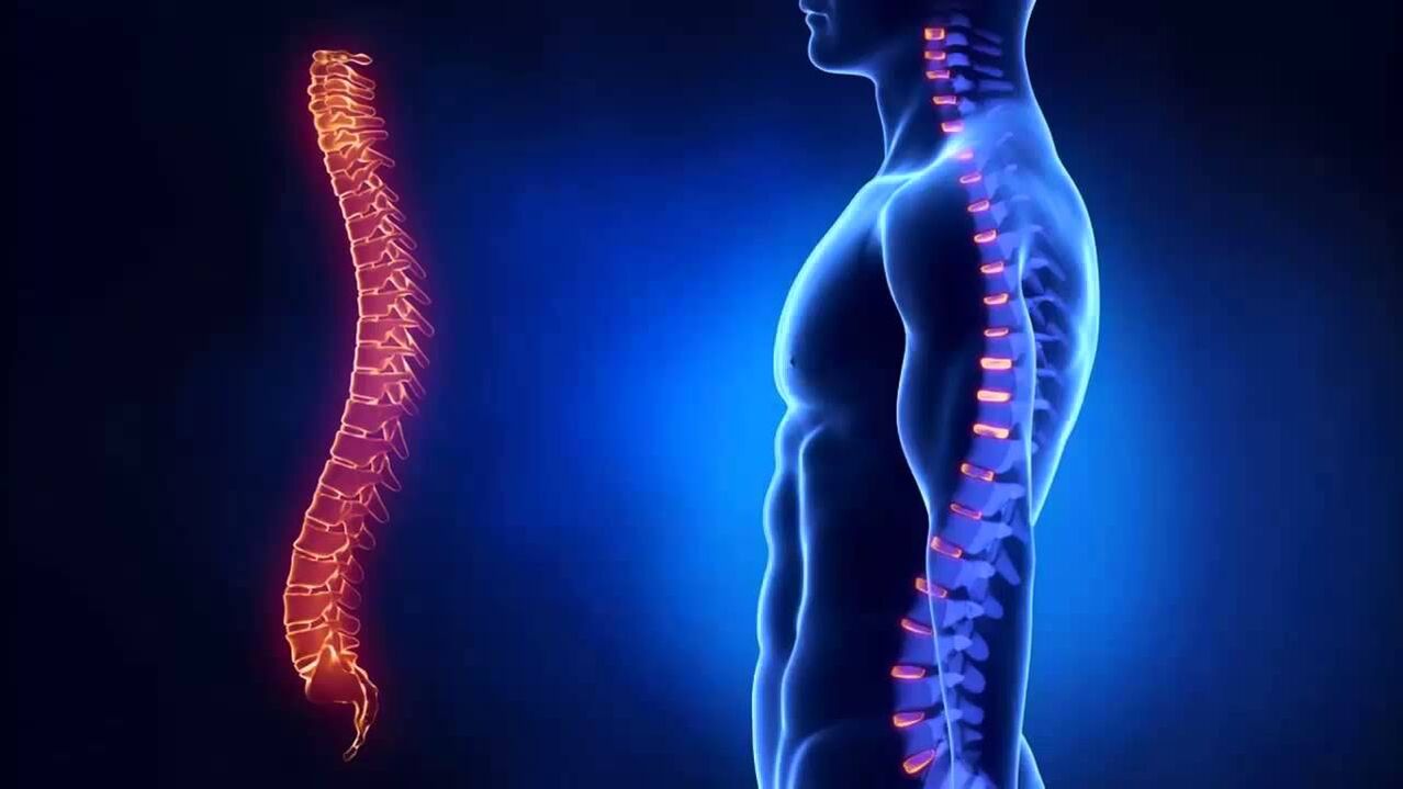 osteocondrosi
